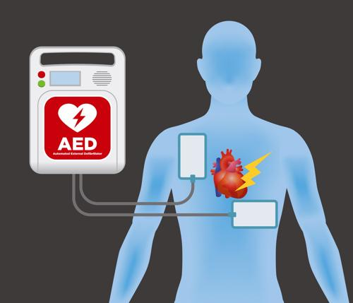 The Basics of an AED (Automated External Defibrillator)